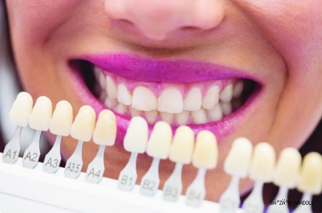 Zirkonyum doğal diş görünümünü koruyor!